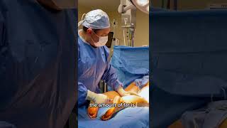 Is lipo for lipedema cheaper than traditional liposuction Does insurance cover it  Dr Volshteyn [upl. by Ushijima]