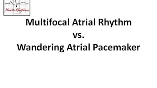 Multifocal Atrial Arrhythmia vs Wandering Atrial Pacemaker [upl. by Raybourne656]