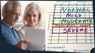 How to read an Audiogram  Understanding your audiogram  Hearing Evaluation Report Understanding [upl. by Surtimed39]