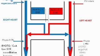 Complete Transposition of great arteries  hemodynamics amp physiology [upl. by Ullman]