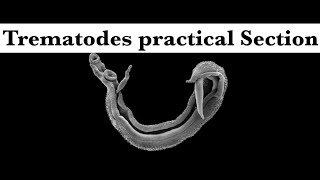 Parasitology practical part 1 Trematodes section [upl. by Devad212]