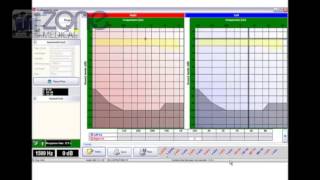 Zone Medical Audiometer PC Based [upl. by Euqinot]