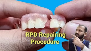 Removable partial denture repairing How to repair a broken partial dentur  Dental Art by Haider [upl. by Aserahs431]