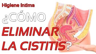 ¿Por qué se produce la cistitis Formas de eliminar la infección [upl. by Wilonah442]