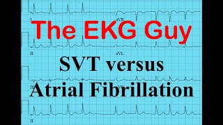 EKGECG  SVT vs Atrial Fibrillation  The EKG Guy  wwwEKGmd [upl. by Africah]