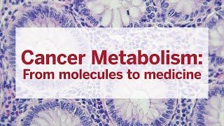 Cancer Metabolism From molecules to medicine [upl. by Maharba]