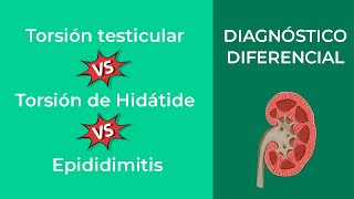 Torsión testicular vs Torsión de Hidátide vs Epididimitis Diagnóstico Diferencial [upl. by Sylas]