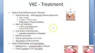 Ophthalmology 088 c Vernal KeratoConjunctivitis Spring Catarrh Treatment How [upl. by Irving]