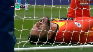 Hugo Lloris Broken Arm injury vs Brighton amp Hove Albion 5102019 [upl. by Aneis]