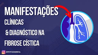 Fibrose Cística  manifestações clínicas e diagnóstico [upl. by Etyak]