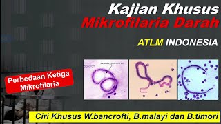 Kajian Khusus Ciri Mikrofilaria  W bancrofti B malayi dan B timori [upl. by Susanne216]