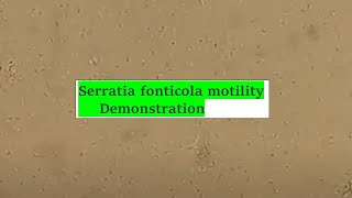 Serratia fonticola motility [upl. by Gertrud]