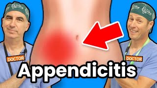 Appendicitis  How Do I Know If I Have Appendicitis [upl. by Ireland]