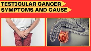 Testicular Cancer Symptoms and Causes of Testicular Cancer and Treatment Your Doctor [upl. by Aivatnuahs]