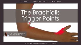 The Brachialis Trigger Points [upl. by Cherida]