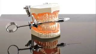 Teeth Teeth TeethThe Filling Process [upl. by Ahsatel]