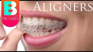 Things to Know Before Invisalign  Clear Aligner Therapy [upl. by Akilaz]