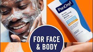 Clear Your Acne amp Blemishes PanOxyl Acne Face Wash Honest Review Clear Your Skin With This Product [upl. by Suirtimed371]