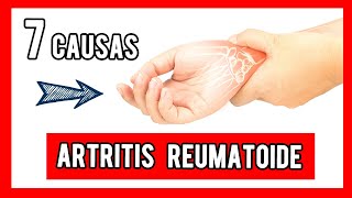 Los síntomas de la ARTRITIS REUMATOIDE 😰 [upl. by Belsky754]