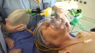 Intubation orotrachéale IOT  bases anatomiques et technique de réalisation [upl. by Yenittirb900]