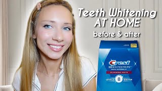 Crest 3D WHITESTRIPS Before amp After  AtHome Teeth Whitening [upl. by Yeo165]