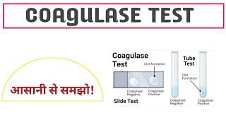 Coagulase Test ll Purpose ll Principle ll Procedure ll result ll in hindi ll [upl. by Arihsat]