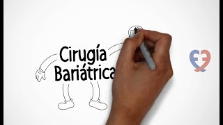 ¡Descubre cómo se realiza una Cirugía Bariátrica [upl. by Olegnaed93]