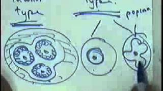 SYSTEMIC PATHOLOGY anaemia and lymphoma DR SAMEH GHAZY [upl. by Wiggins517]