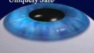 Intralase LASIKCustom LASIK at Eye Doctors of Washington DC [upl. by Ellenrahc]