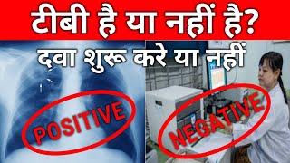 XRAY में टीबी लेकिन बलगम रिपोर्ट नेगेटिव   टीबी है कि नहीं दावा खाए या नहीं  🤔 [upl. by Pelaga702]