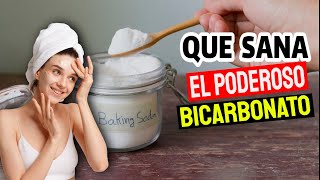 Cómo Utilizar BICARBONATO De SODIO En La Cara Y La Piel  Para Que SIRVE El Bicarbonato De Sodio [upl. by Atiekal]