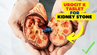 Urocit K Tablet Understanding Its Common Uses in Kidney Stone Prevention [upl. by Dnomal]