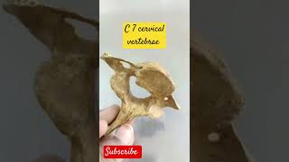 C 7 cervical vertebrae Anatomy anatomy mbbsbdsbamsbhmseducational cervical vertebra [upl. by Inafit]