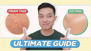 ULTIMATE GUIDE to Treat amp Prevent BLACKHEADS WHITEHEADS TINY BUMPS for FILIPINO SKIN  Jan Angelo [upl. by Yssenhguahs857]