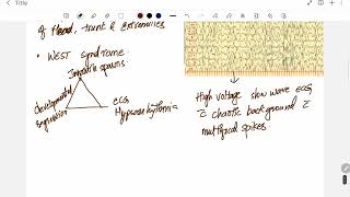 Infantile spasm West syndrome salam seizures pediatric topic for neetpgInicetUpsccmsnextusmle [upl. by Ahrat]