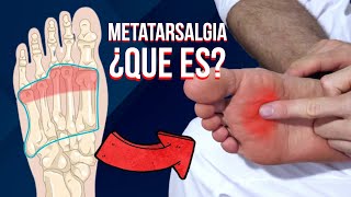 🦶🏻 Que es la METATARSALGIA causas sintomas y tratamiento [upl. by Harhay770]