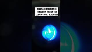 GOLDMANN APPLANATION TONOMETRY MIER ON SLIT LAMP IN COBALT BLUE FILTER [upl. by Nirehs217]