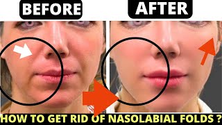 2 HOURS 🛑 MIX  FACIAL EXERCISES FOR NASAL FOLDS SAGGY SKIN FROWN LINES NECK LINES MOUTH LINES [upl. by Dell]