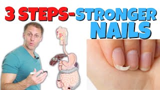 3 Steps to Strengthen Brittle Fingernails [upl. by Deragon]