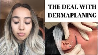 THE DEAL WITH DERMAPLANING [upl. by Amliv]