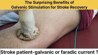 The Surprising Benefits of Galvanic Stimulation for Stroke Recovery [upl. by Irelav]