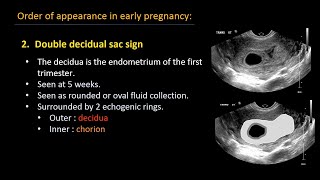 Ultrasound of normal early pregnancy [upl. by Connel]