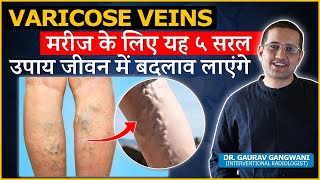 5 Simple Lifestyle Changes To Prevent Varicose Veins  Dr Gaurav Gangwani IR [upl. by Jessee]