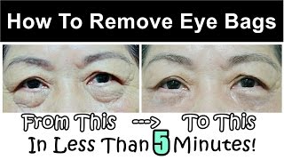 How To Get Rid of amp Remove Eye Bags Instantly Ageless Puffy Eye Bag Removal [upl. by Tamarra]