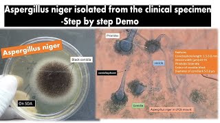 Aspergillus niger Isolation from clinical sapmle Steps [upl. by Gurolinick]