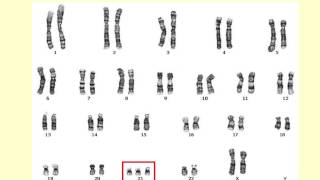 AS level E1 Chromosomes and the cell cycle Ms Cooper [upl. by Ayotna24]