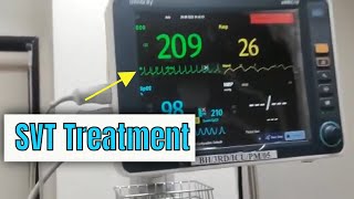 Adenosine in Supraventricular tachycardia SVT How to administer and how it works [upl. by Leivad75]