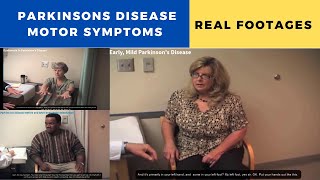 Parkinsons Disease Motor Symptoms  Real Fooatages [upl. by Macdonald897]