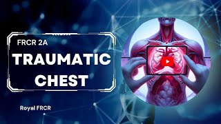 17  Chest Imaging for FRCR [upl. by Airaet]