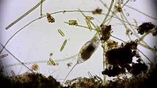 🔬 Rädertierchen Rotifer  Leben im Wassertropfen  microorganisms under microscope life in a drop [upl. by Etnuad]